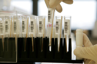 Atrofia muscolare spinale, ok dall’Ue a terapia genica sopra i due anni