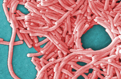 Legionella, l’epidemia a New York e il legame con l’aria condizionata