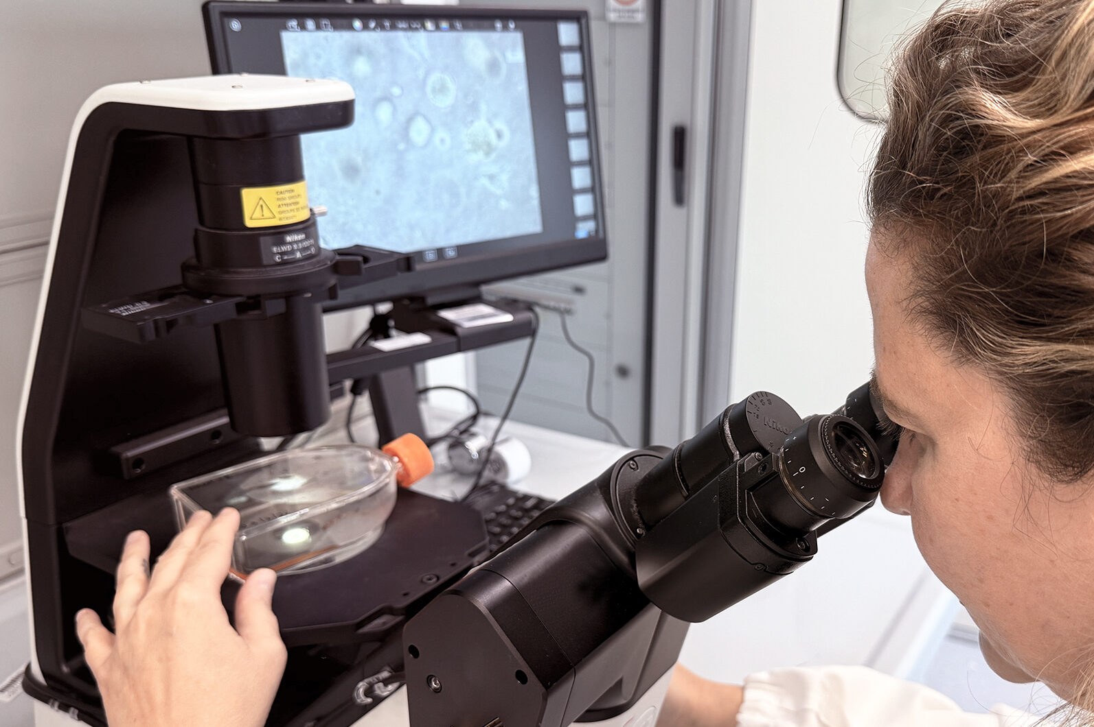 Tumore, ecco le nuove cellule natural killer ingegnerizzate per batterlo Tumore, ecco le nuove cellule natural killer ingegnerizzate per batterlo