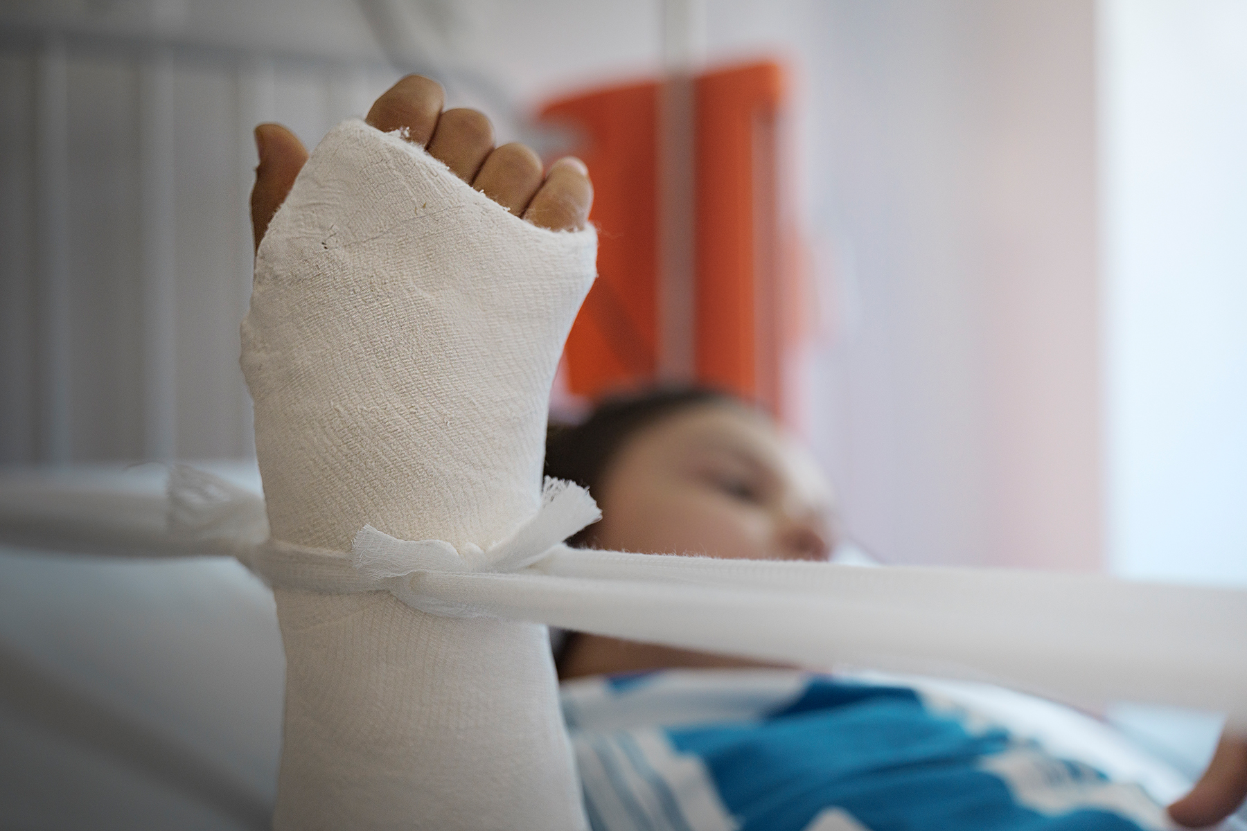 Traumi e infortuni estivi, ecco le ore più pericolose per i bambini