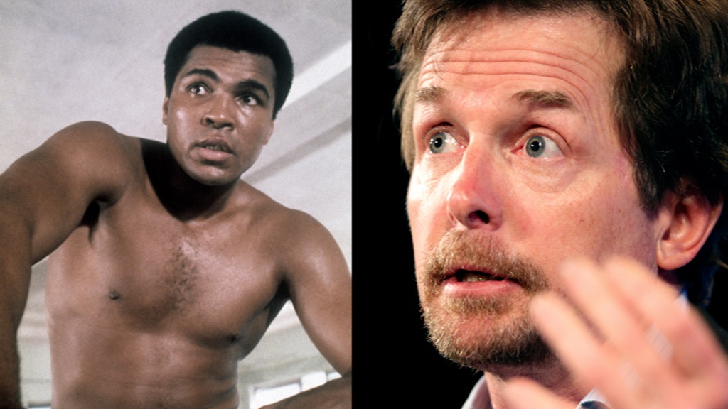 morbo di parkinson i malati famosi da michael j fox a muhammad ali da Lapresse.it morbo di parkinson i malati famosi da michael j fox a muhammad ali