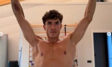 Marc Marquez, la foto impressionante della spalla dopo 7 operazioni