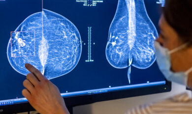 Ottobre Rosa, il programma di prevenzione di Artemisia Lab