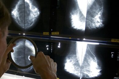 Tornare al lavoro dopo il tumore al seno, l’iniziativa per le donne