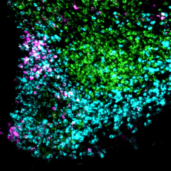 Metabolismo attivato dal freddo, la scoperta alleata del controllo del peso Metabolismo attivato dal freddo, la scoperta alleata del controllo del peso