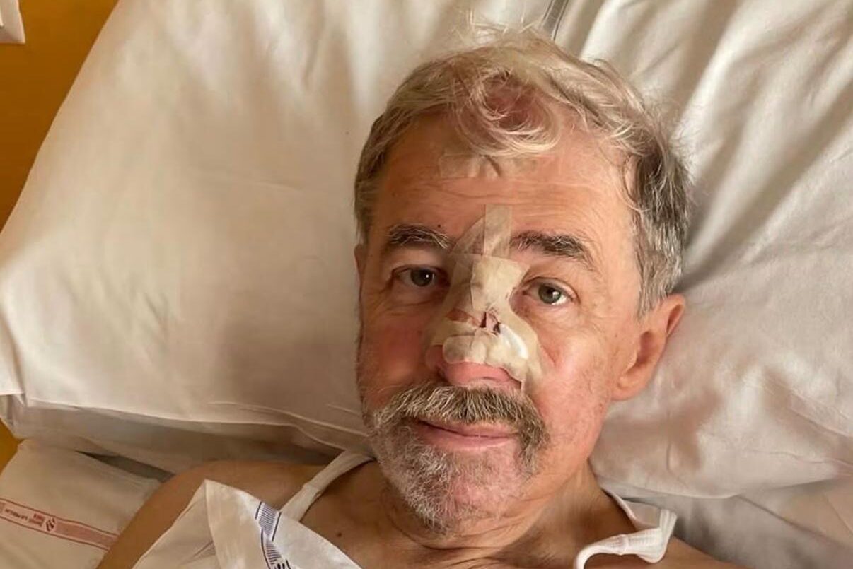 Marco Bucci e il basalioma, alla scoperta di un tumore della pelle meno noto