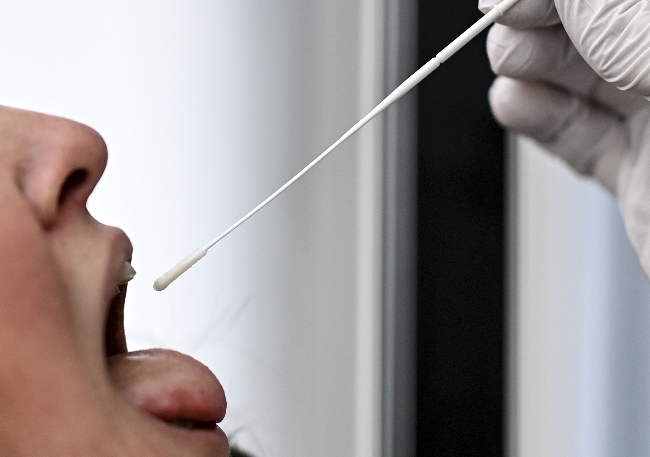 Mal di gola in agguato: non è ancora influenza, occhio a placche e farmaci Mal di gola in agguato: non è ancora influenza, occhio a placche e farmaci